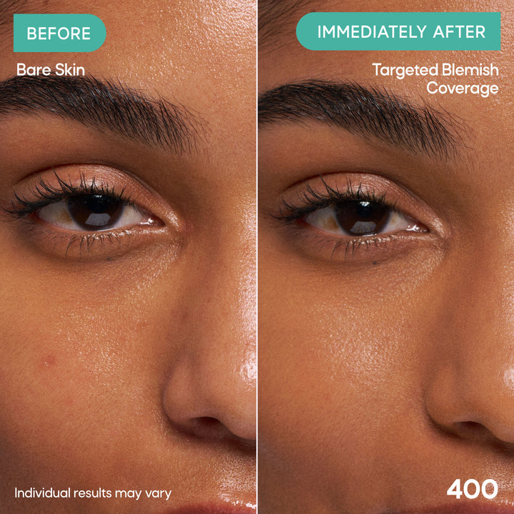 Clear Complexion Concealer