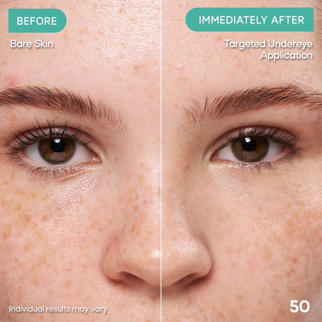 Clear Complexion Concealer