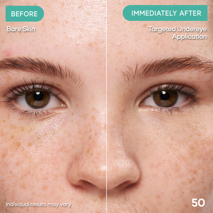 Clear Complexion Concealer